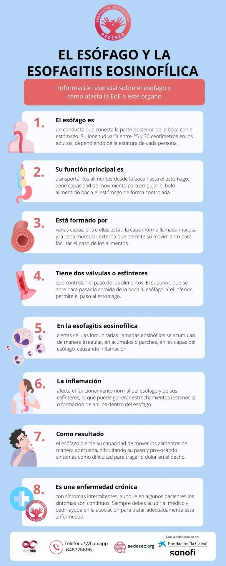 El esófago y la esofagitis eosinofílica E